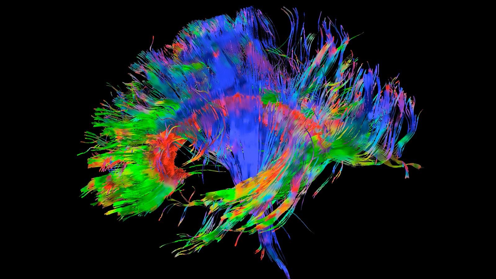 Brain structure